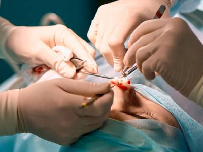 Trauma Surgery